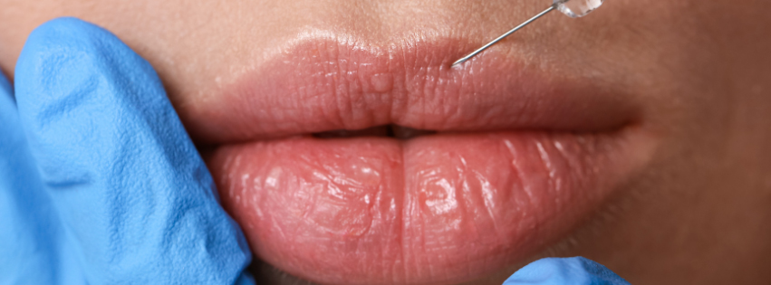 woman brushing her teeth